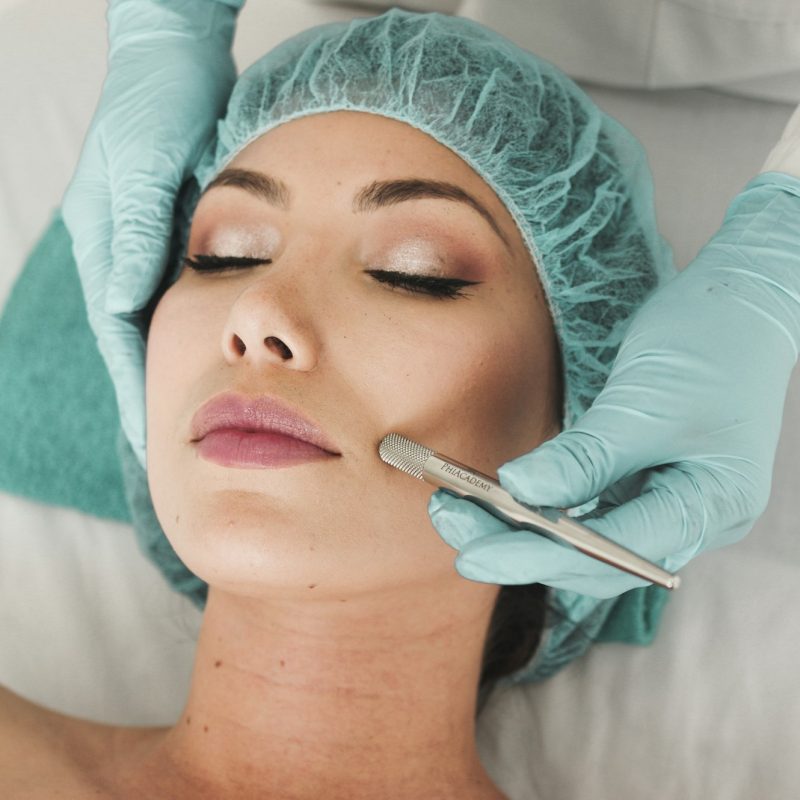 A practitioner working across a patient's cheek during a no-downtime laser session