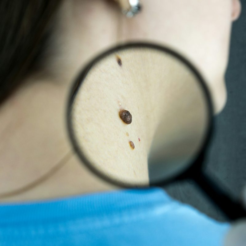 Multispectral Skin Imaging