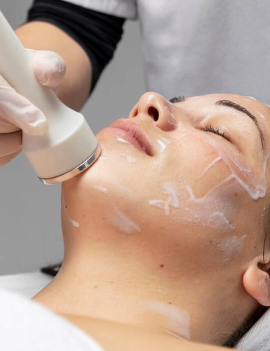 A focused-ultrasound HIFU handpiece during a non-surgical face lifting session