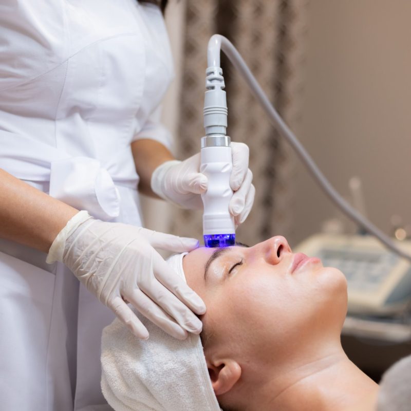 RF Microneedling System